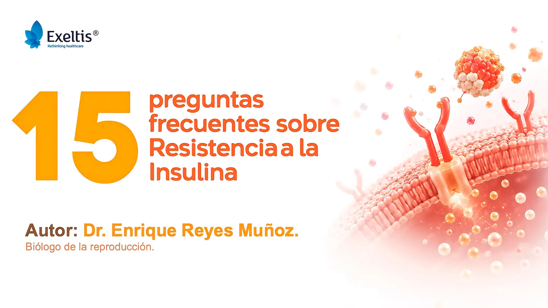 15 preguntas frecuentes sobre la Resistencia a la Insulina