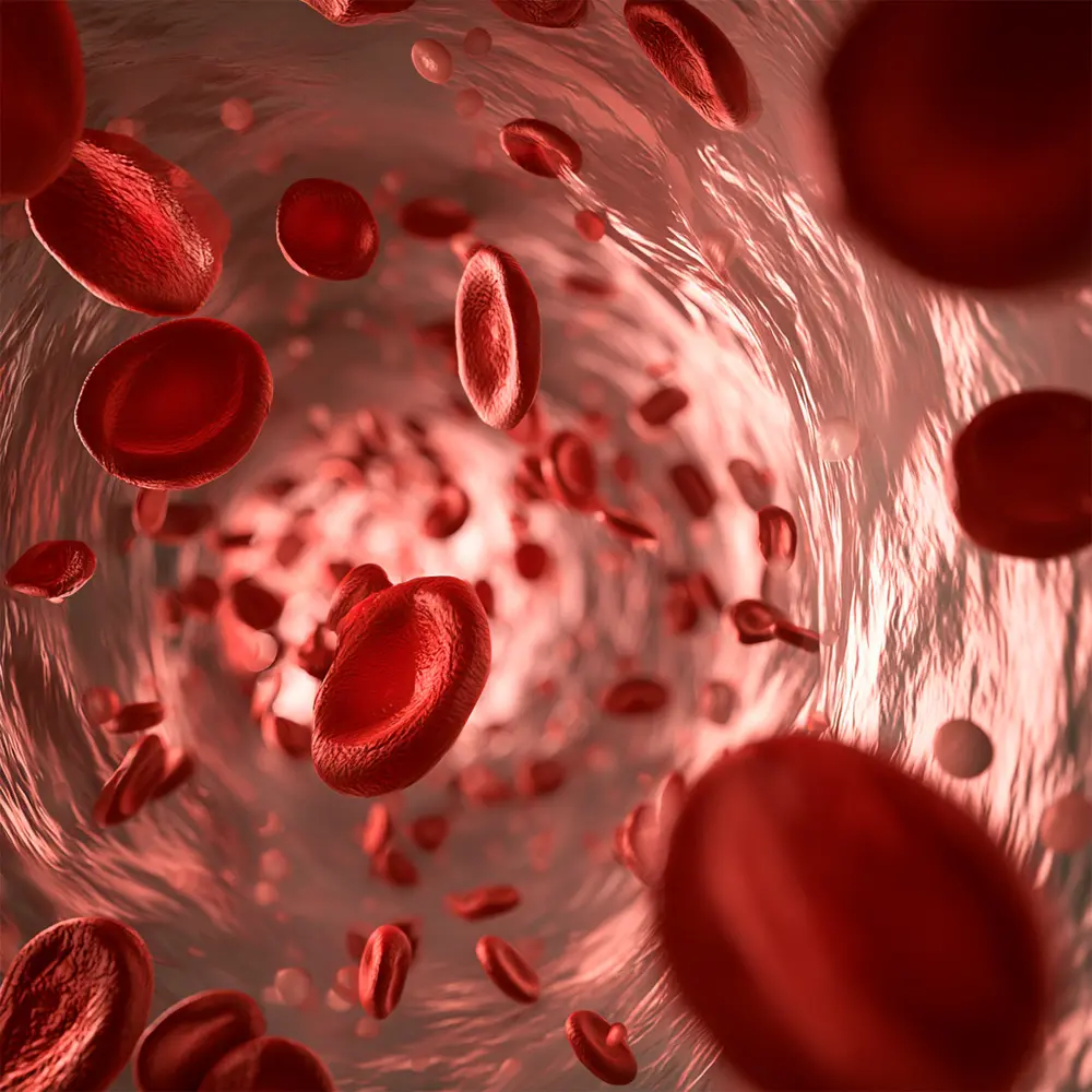 Anemia Ferropénica