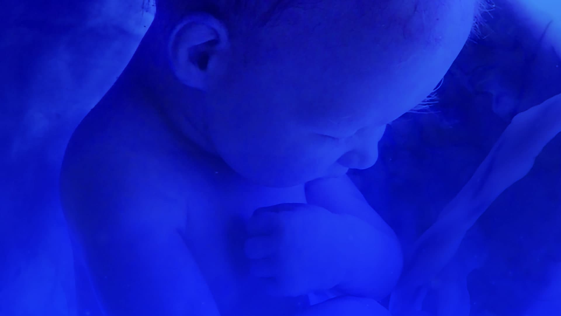 Cuidados de salud Materno-fetal