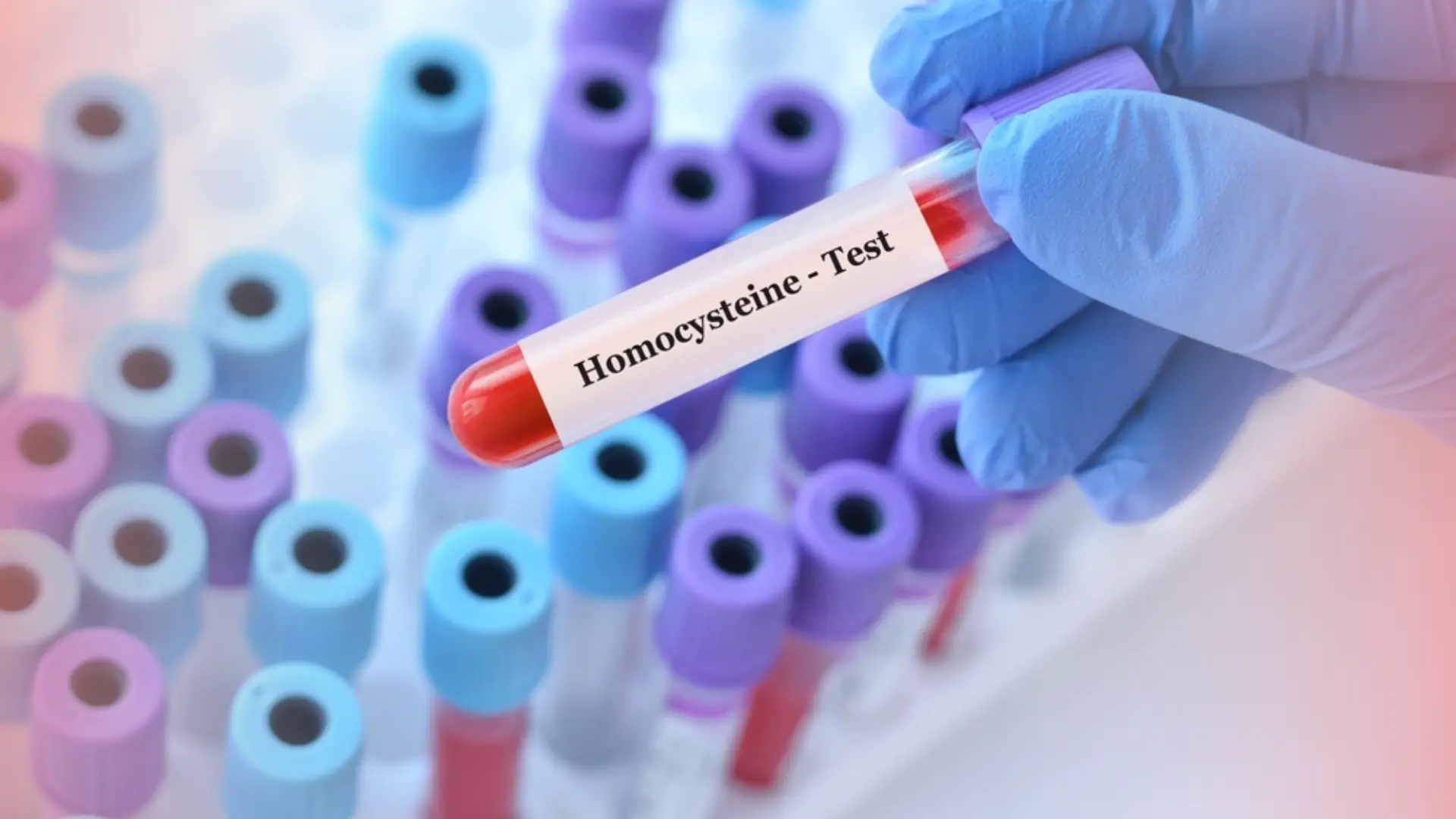 La homocisteína y su papel en la prevención de enfermedades