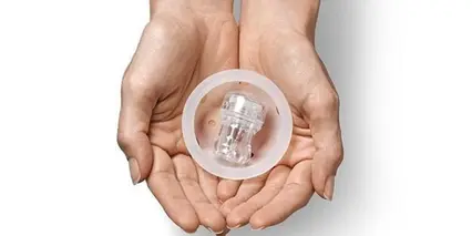 Cultivo embrionario intravaginal: una alternativa exitosa para la fertilización in vitro estándar.