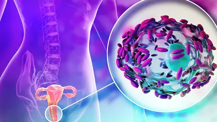 El impacto de la vaginosis bacteriana sobre la reproducción