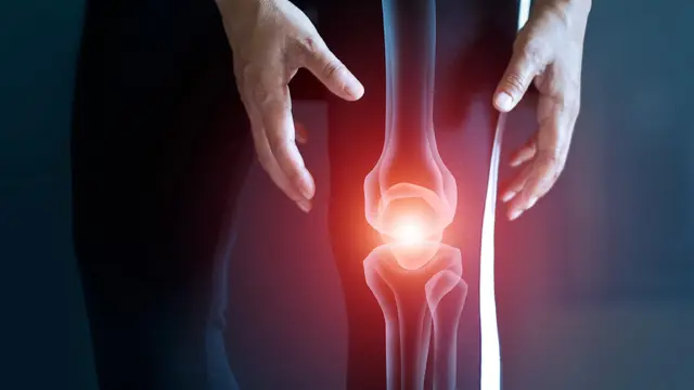 Condromodulación y Tolerogénesis en el tratamiento de la Osteoartritis  