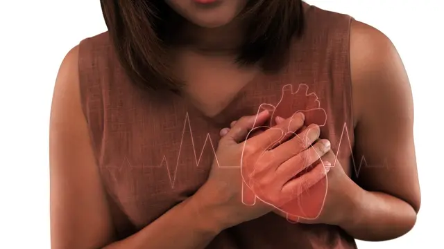 Anticoncepción y riesgo cardiovascular